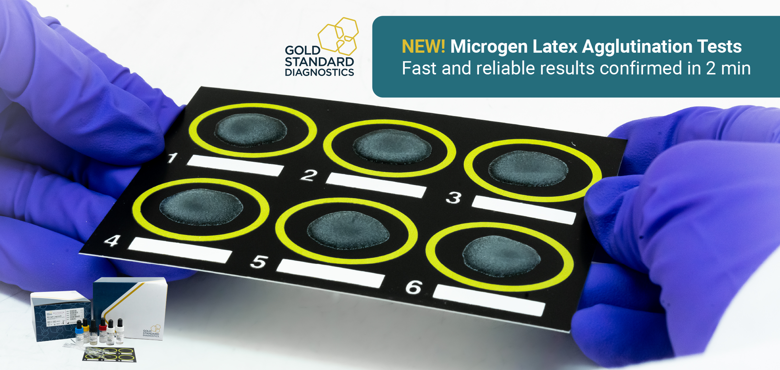 Gold Standard Diagnostics launches Microgen Latex Agglutination tests!